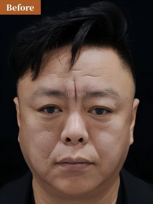 中华24小时在线套医保微信能用吗怎么弄？官方解答来了